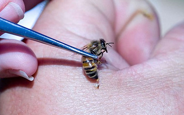Гирудотерапия и апитерапия – это народные (старорусские) методы лечения пиявками, пчёлами